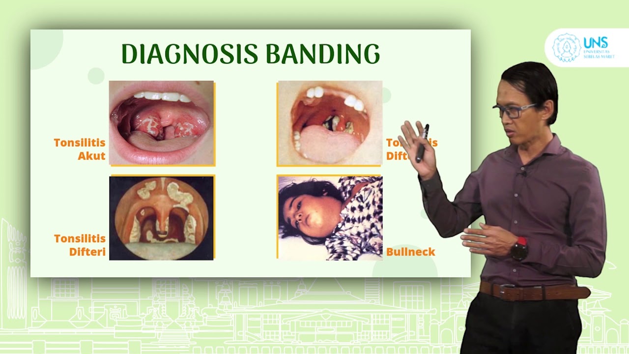 Tonsilitis
